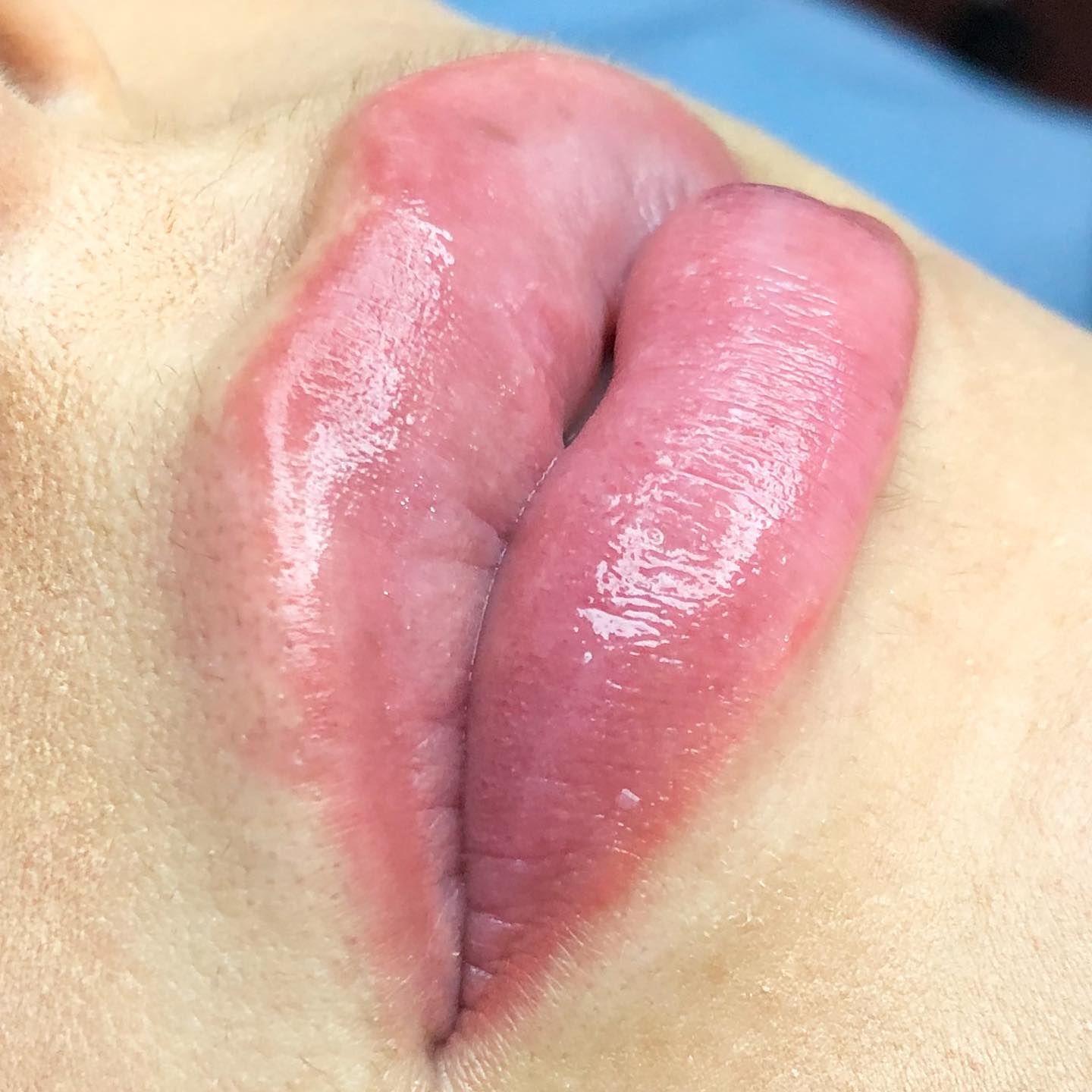 Lábios com hidragloss
