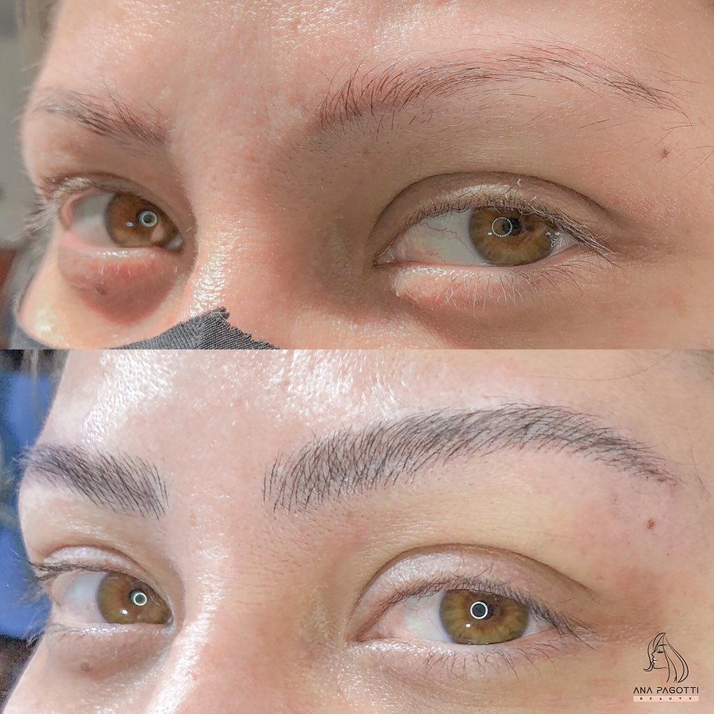 Sobrancelhas com nanopigmentação