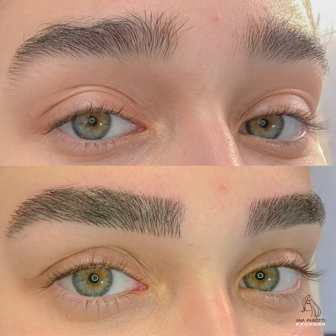 Sobrancelhas com nanopigmentação