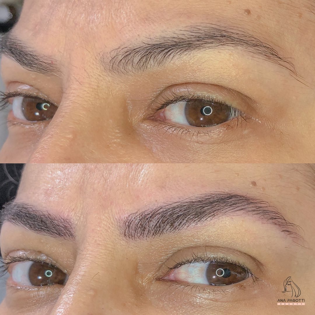 Sobrancelhas com nanopigmentação